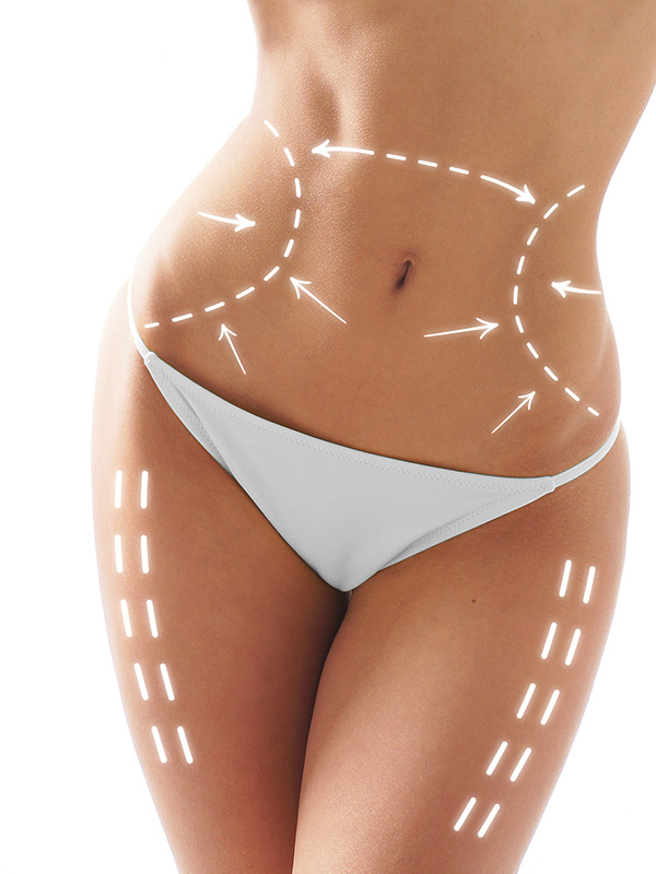Chirurgie de la silhouette