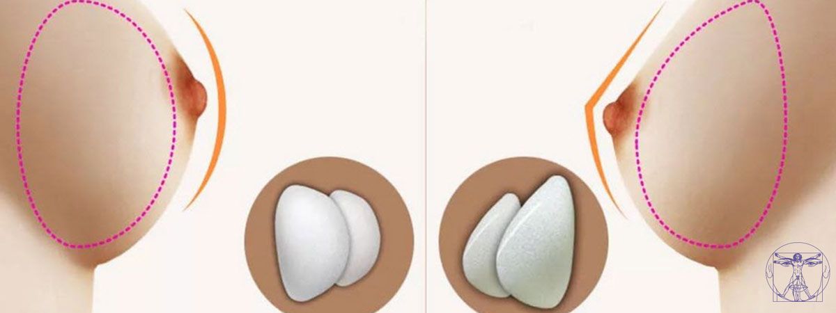 cet_ft_body_1200-450_36-47b3d3ab Augmentation mammaire