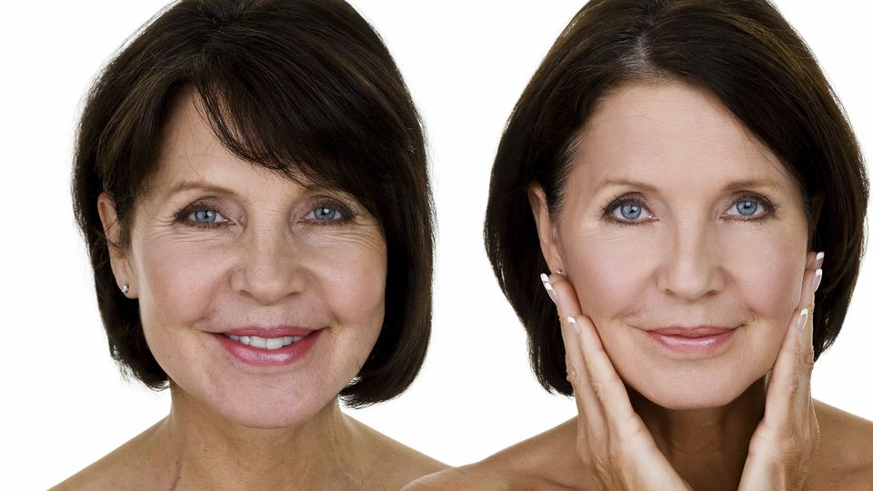 dhz_960-540_02-b6b8e3c4 Lifting frontal